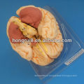 ISO Advanced Brain Anatomical model, modelo de cerebro 3D